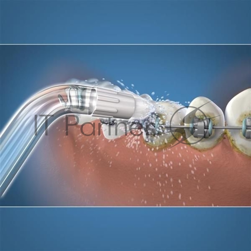 Насадка для ирригатора Waterpik OD-100E (упак.:2шт) WP-360/450/462/463/465