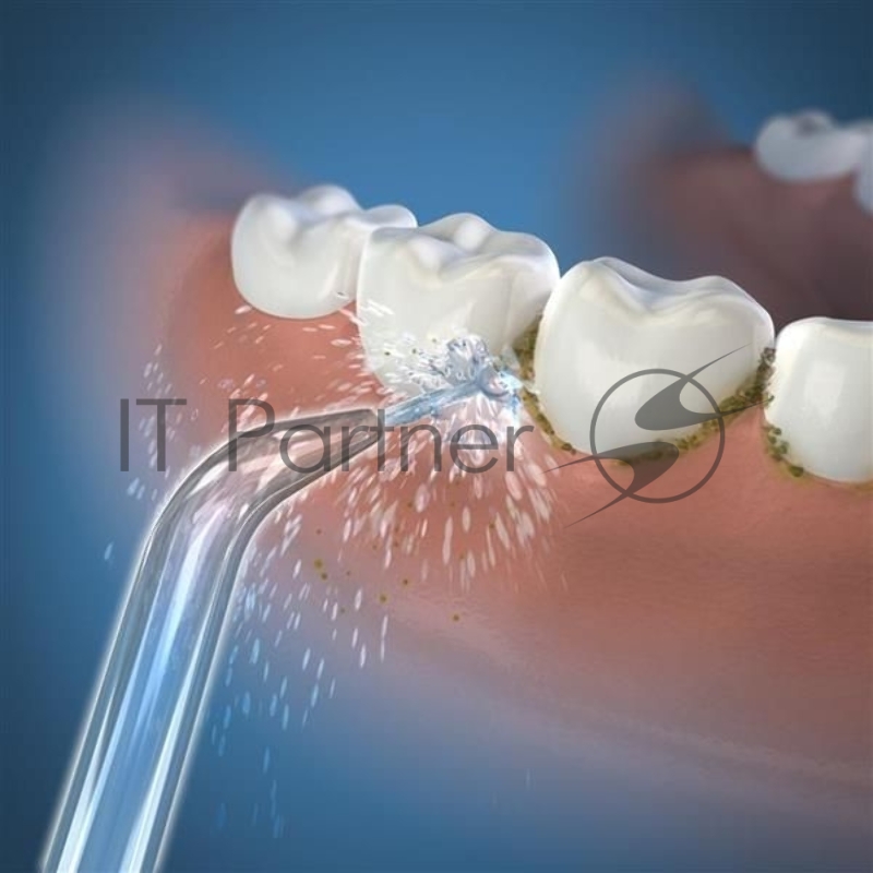 Насадка для ирригатора Waterpik JT-450E (упак.:2шт) WP-360/450/462/463/465